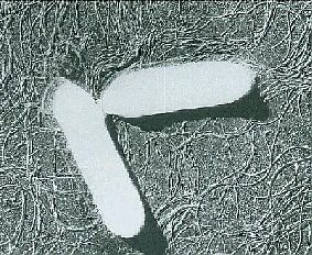ボツリヌス菌